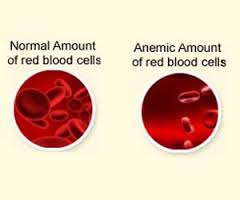 anemia是什么意思