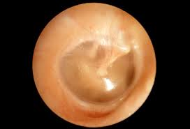 eardrum是什么意思