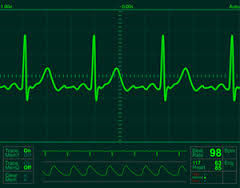 electrocardiogram是什么意思