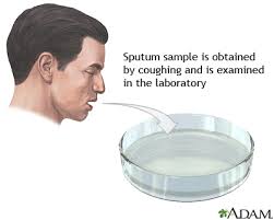 sputum是什么意思