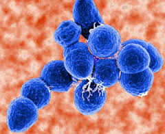 streptococcus是什么意思