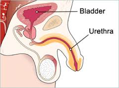 urethritis是什么意思