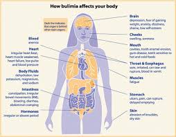 bulimia是什么意思