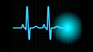 cardiogram是什么意思