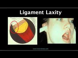 laxity是什么意思