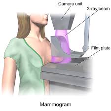 mammogram是什么意思
