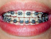 orthodontia是什么意思