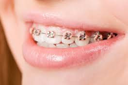 orthodontist是什么意思