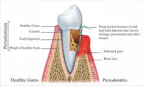 periodontics是什么意思