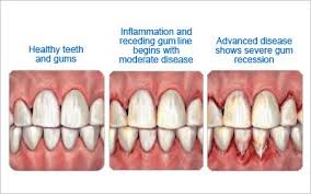 periodontist是什么意思