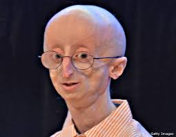 progeria是什么意思